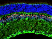 Mouse Retina